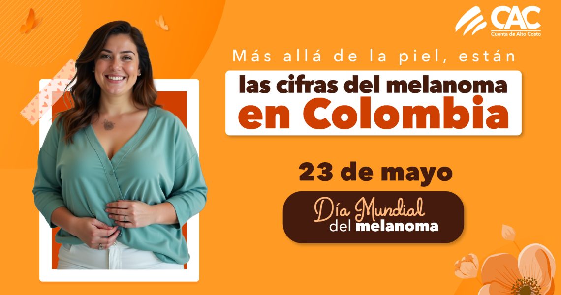 melanoma_miniatura