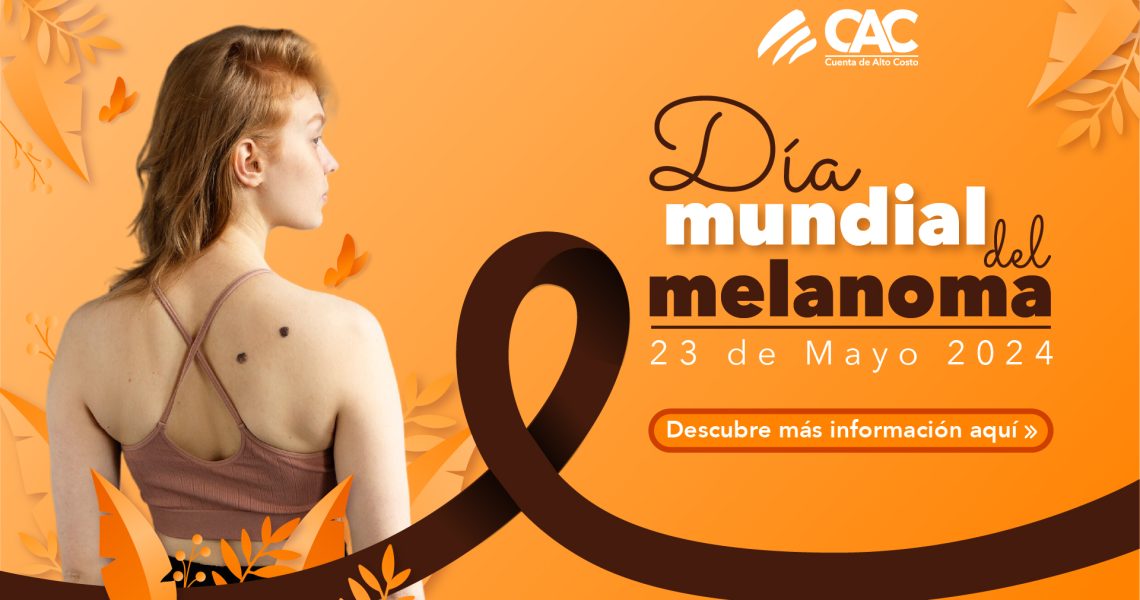 Melanoma_miniatura