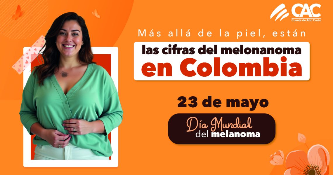 melanoma_miniatura
